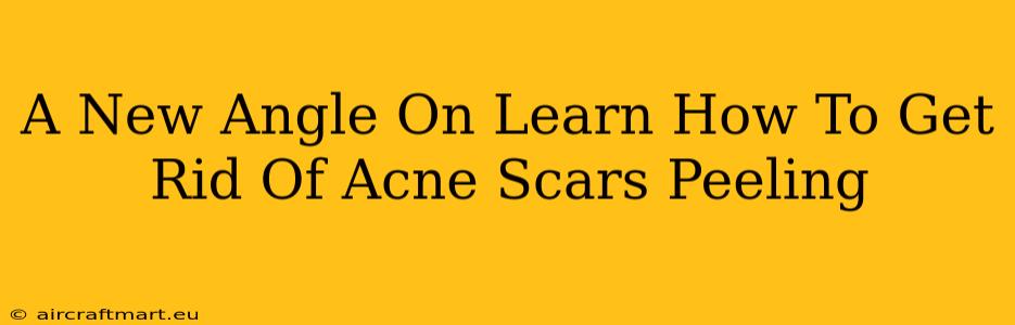 A New Angle On Learn How To Get Rid Of Acne Scars Peeling