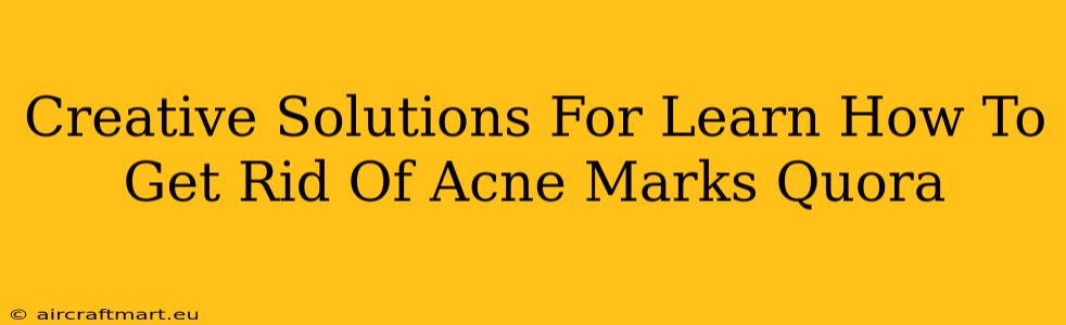 Creative Solutions For Learn How To Get Rid Of Acne Marks Quora