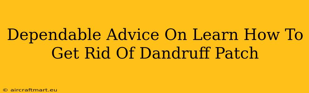 Dependable Advice On Learn How To Get Rid Of Dandruff Patch