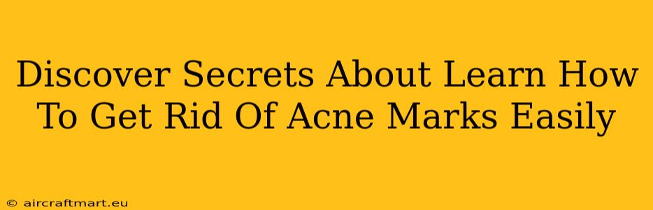 Discover Secrets About Learn How To Get Rid Of Acne Marks Easily