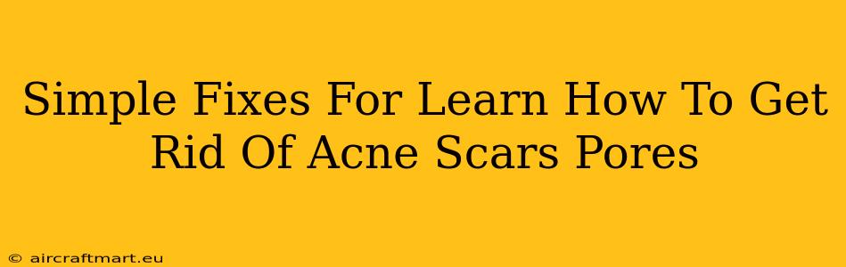 Simple Fixes For Learn How To Get Rid Of Acne Scars Pores